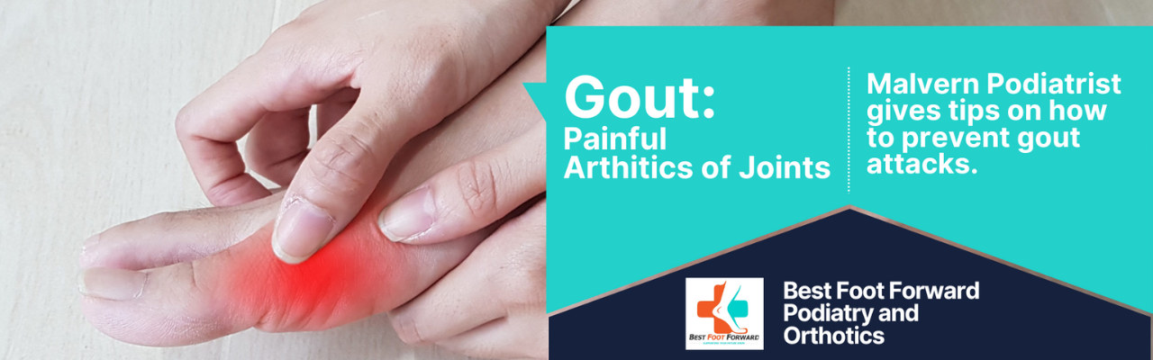 Read more about the article Gout – Painful arthritis of joints. Malvern Podiatrist gives tips on how to prevent gout attacks.