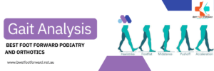 Read more about the article Gait analysis – What does this mean ?