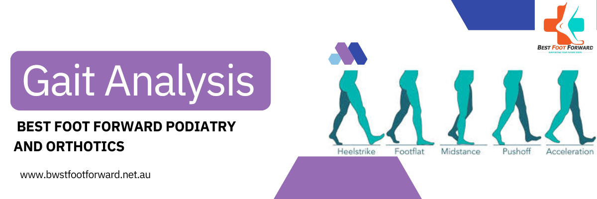 Gait analysis – What does this mean ?